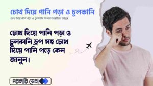 চোখ দিয়ে পানি পড়া ও চুলকানি